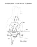 KNEE JOINT PROSTHESIS SYSTEM AND METHOD FOR IMPLANTATION diagram and image