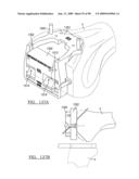 KNEE JOINT PROSTHESIS SYSTEM AND METHOD FOR IMPLANTATION diagram and image