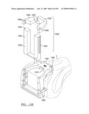 KNEE JOINT PROSTHESIS SYSTEM AND METHOD FOR IMPLANTATION diagram and image