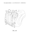 KNEE JOINT PROSTHESIS SYSTEM AND METHOD FOR IMPLANTATION diagram and image