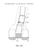 KNEE JOINT PROSTHESIS SYSTEM AND METHOD FOR IMPLANTATION diagram and image