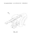 KNEE JOINT PROSTHESIS SYSTEM AND METHOD FOR IMPLANTATION diagram and image