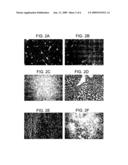 Animal Model Having a Chimeric Human Liver and Susceptible to Human Hepatitis C Virus Infection diagram and image