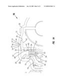 Double overlap backing plate attachment diagram and image