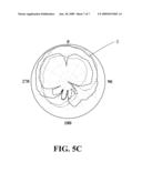 CIRCULARLY-POLARIZED DIELECTRIC RESONATOR ANTENNA diagram and image