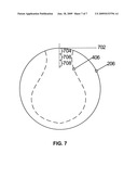 REFRACTIVE-DIFFRACTIVE MULTIFOCAL LENS diagram and image