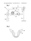 Bite device used with a panorama x-ray device diagram and image