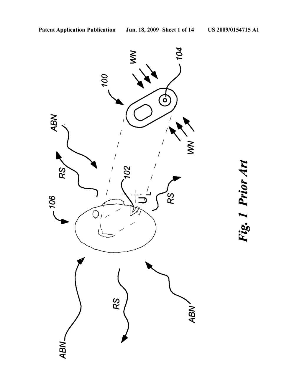 Apparati and methods for sound transduction with minimal interference from background noise and minimal local acoustic radiation - diagram, schematic, and image 02