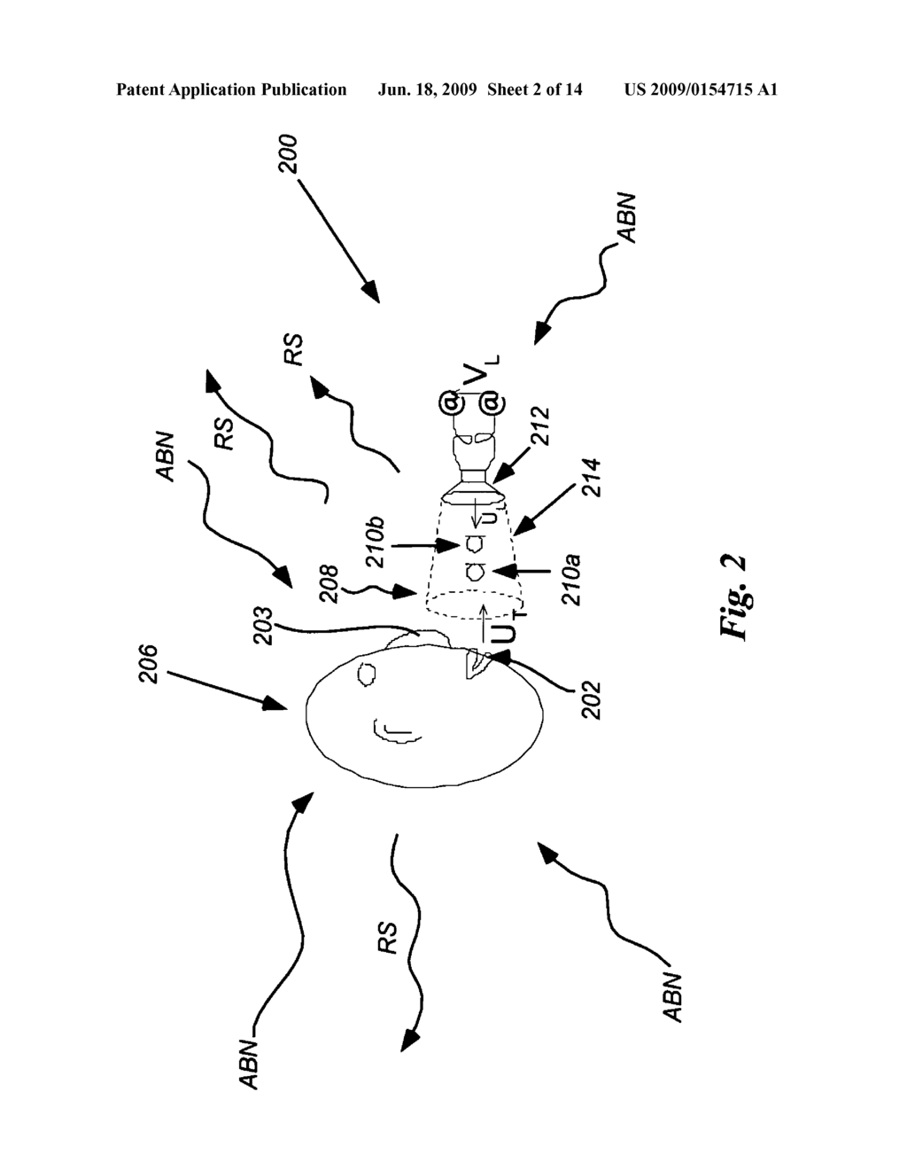 Apparati and methods for sound transduction with minimal interference from background noise and minimal local acoustic radiation - diagram, schematic, and image 03