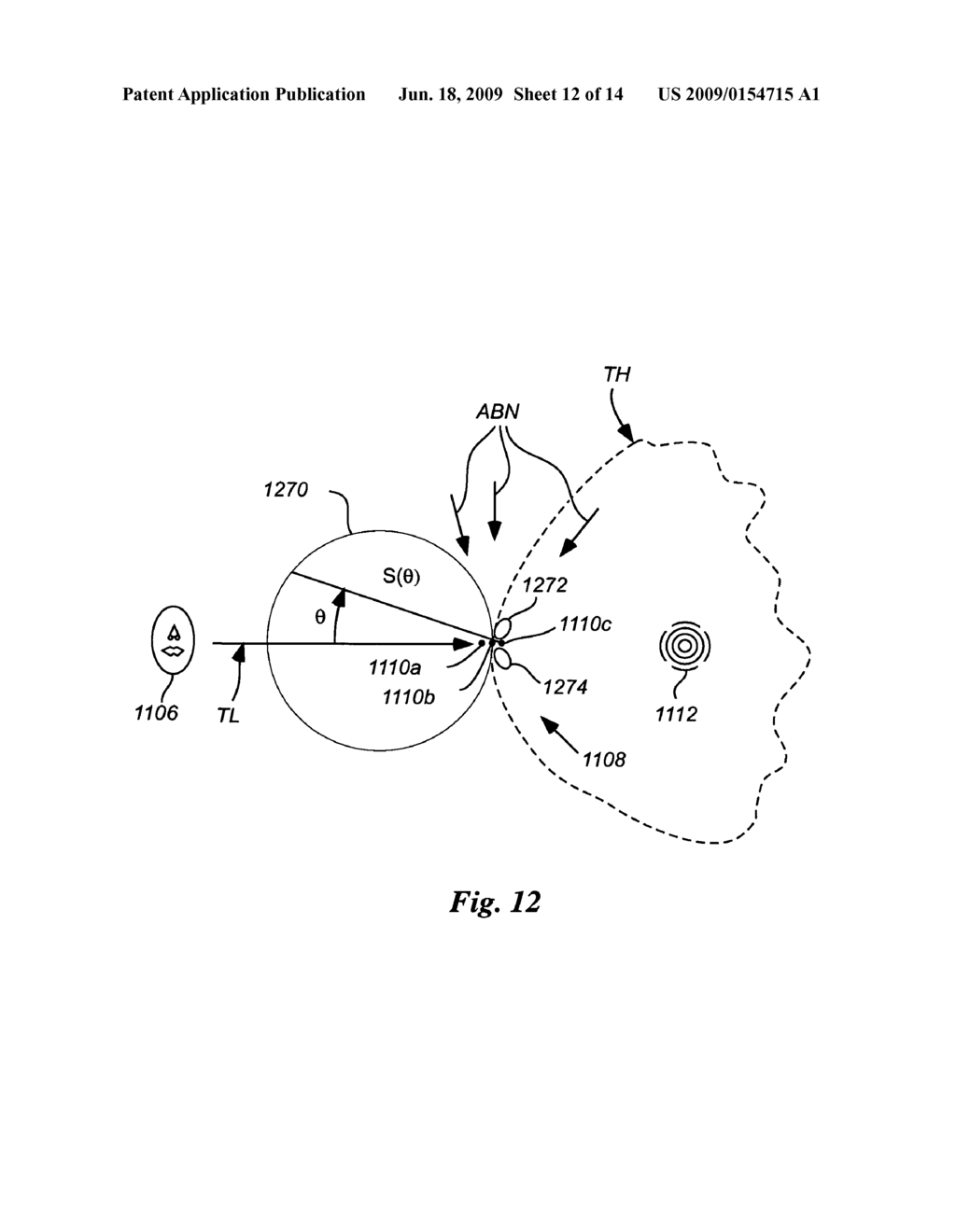 Apparati and methods for sound transduction with minimal interference from background noise and minimal local acoustic radiation - diagram, schematic, and image 13