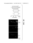 COMPOSITIONS AND METHODS FOR BONE STRENGTHENING diagram and image