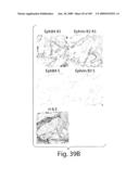 Polypeptide compounds for inhibiting angiogenesis and tumor growth diagram and image