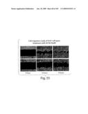 Polypeptide compounds for inhibiting angiogenesis and tumor growth diagram and image