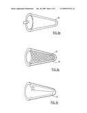 REPLACEMENT BONE TISSUE diagram and image