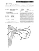 Occlusion of Fallopian Tubes diagram and image