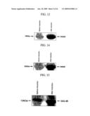 Human Cancer Suppressor Gene, Protein Encoded Therein, Expression Vector Containing The Same, And Cell Transformed By The Vector diagram and image