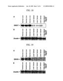 Human Cancer Suppressor Gene, Protein Encoded Therein, Expression Vector Containing The Same, And Cell Transformed By The Vector diagram and image