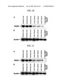Human Cancer Suppressor Gene, Protein Encoded Therein, Expression Vector Containing The Same, And Cell Transformed By The Vector diagram and image