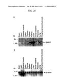 Human Cancer Suppressor Gene, Protein Encoded Therein, Expression Vector Containing The Same, And Cell Transformed By The Vector diagram and image