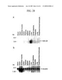 Human Cancer Suppressor Gene, Protein Encoded Therein, Expression Vector Containing The Same, And Cell Transformed By The Vector diagram and image