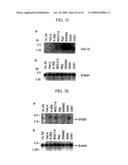 Human Cancer Suppressor Gene, Protein Encoded Therein, Expression Vector Containing The Same, And Cell Transformed By The Vector diagram and image