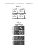 AIMP2-DX2 Gene and SiRNA Targeting AIMP2-DX2 diagram and image