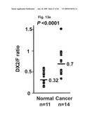 AIMP2-DX2 Gene and SiRNA Targeting AIMP2-DX2 diagram and image