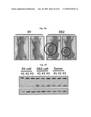 AIMP2-DX2 Gene and SiRNA Targeting AIMP2-DX2 diagram and image