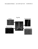 AIMP2-DX2 Gene and SiRNA Targeting AIMP2-DX2 diagram and image