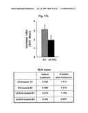 AIMP2-DX2 Gene and SiRNA Targeting AIMP2-DX2 diagram and image