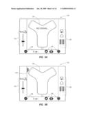 Integrated System for Intravascular Placement of a Catheter diagram and image