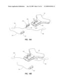 Integrated System for Intravascular Placement of a Catheter diagram and image