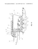 Integrated System for Intravascular Placement of a Catheter diagram and image