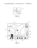 Integrated System for Intravascular Placement of a Catheter diagram and image