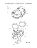 RADIOPAQUE AND SEPTUM-BASED INDICATORS FOR A MULTI-LUMEN IMPLANTABLE PORT diagram and image