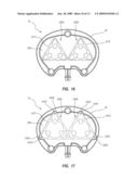 RADIOPAQUE AND SEPTUM-BASED INDICATORS FOR A MULTI-LUMEN IMPLANTABLE PORT diagram and image