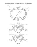 RADIOPAQUE AND SEPTUM-BASED INDICATORS FOR A MULTI-LUMEN IMPLANTABLE PORT diagram and image