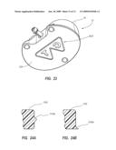 RADIOPAQUE AND SEPTUM-BASED INDICATORS FOR A MULTI-LUMEN IMPLANTABLE PORT diagram and image