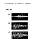 DEVICE AND METHOD FOR IN VIVO FLOW CYTOMETRY USING THE DETECTION OF PHOTOACOUSTIC WAVES diagram and image