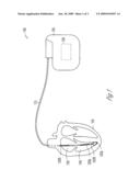 PAINLESS NON-STIMULATING LEAD IMPEDANCE MEASUREMENT diagram and image