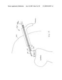 ROTATOR CUFF PATCH DELIVERY DEVICE diagram and image