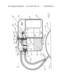 Suctioning system, method and kit diagram and image