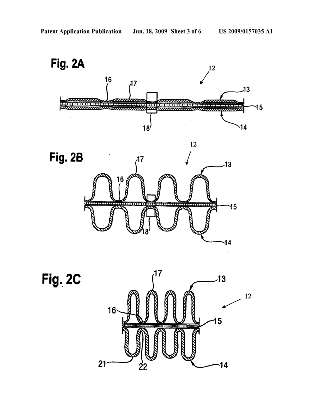 Absorbent Article with Composite Sheet Comprising Elastic Material - diagram, schematic, and image 04