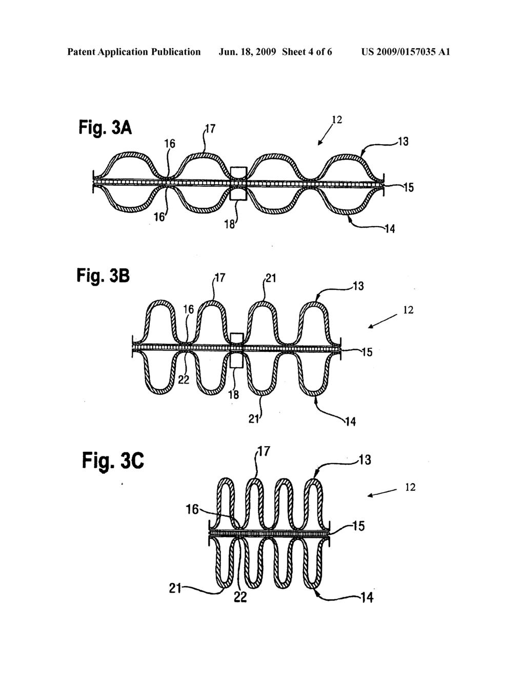 Absorbent Article with Composite Sheet Comprising Elastic Material - diagram, schematic, and image 05