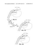 DEVICES AND SYSTEMS FOR MINIMALLY INVASIVE SURGICAL PROCEDURES diagram and image