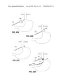 DEVICES AND SYSTEMS FOR MINIMALLY INVASIVE SURGICAL PROCEDURES diagram and image