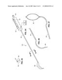 DEVICES AND SYSTEMS FOR MINIMALLY INVASIVE SURGICAL PROCEDURES diagram and image