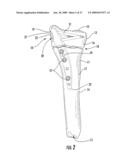 GUIDE ASSEMBLY FOR INTRAMEDULLARY FIXATION AND METHOD OF USING THE SAME diagram and image