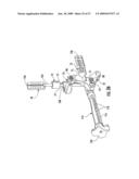 GUIDE ASSEMBLY FOR INTRAMEDULLARY FIXATION AND METHOD OF USING THE SAME diagram and image