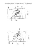 Surgical Drill For Providing Holes At An Angle diagram and image